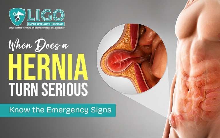 When does a hernia become an emergency
